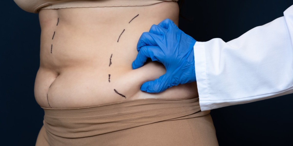 الفرق بين أنواع عملية شفط الدهون في الرياض
