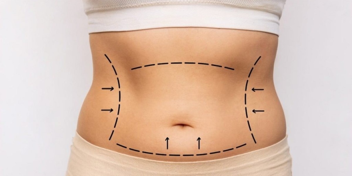 Can I Combine a Tummy Tuck With Other Cosmetic Procedures?