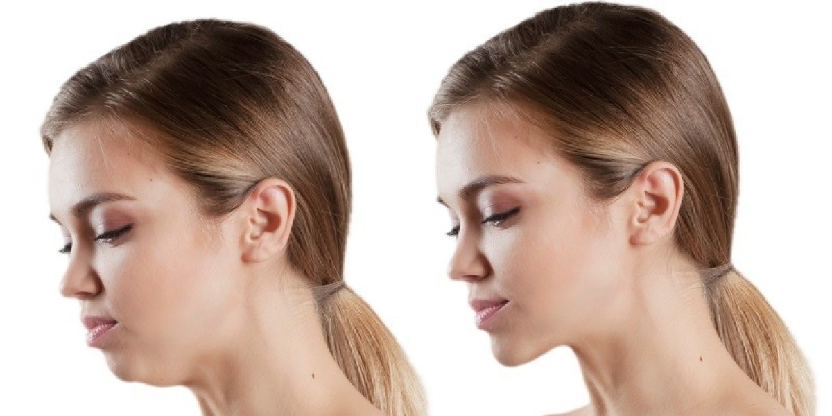 Jaw Surgery in Islamabad – Treatment Options Explained