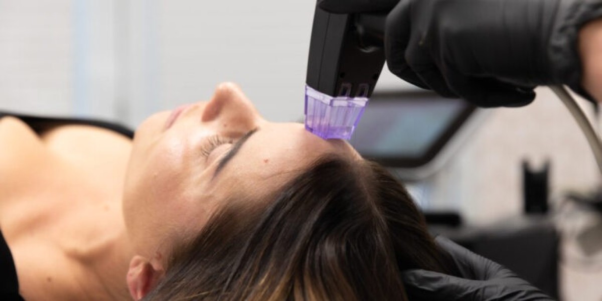 Can Morpheus8 Refresh Tired Skin and Reveal Radiant Tone Instantly?