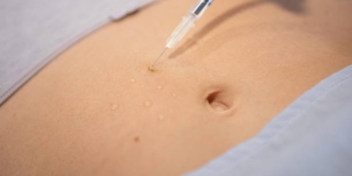 Dubai’s Best Practices for Fat Dissolving Needle Procedures