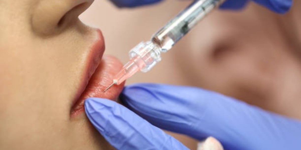 Dermal Fillers in Dubai: Transforming Confidence, One Treatment at a Time