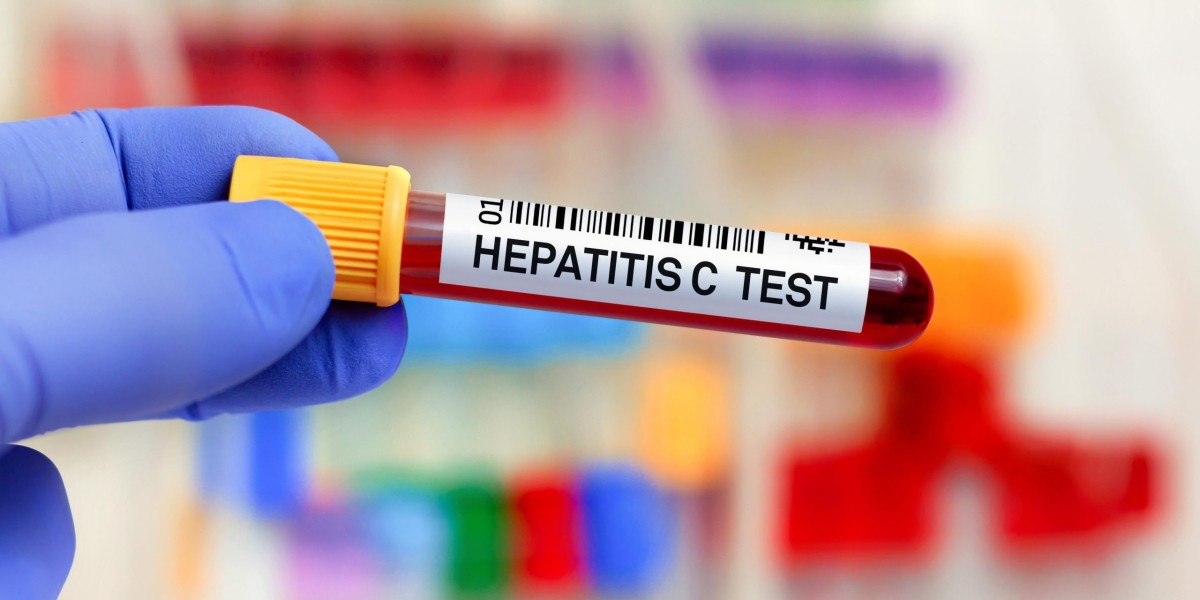 Understanding Hepatitis C Test Reports from Dubai Clinics