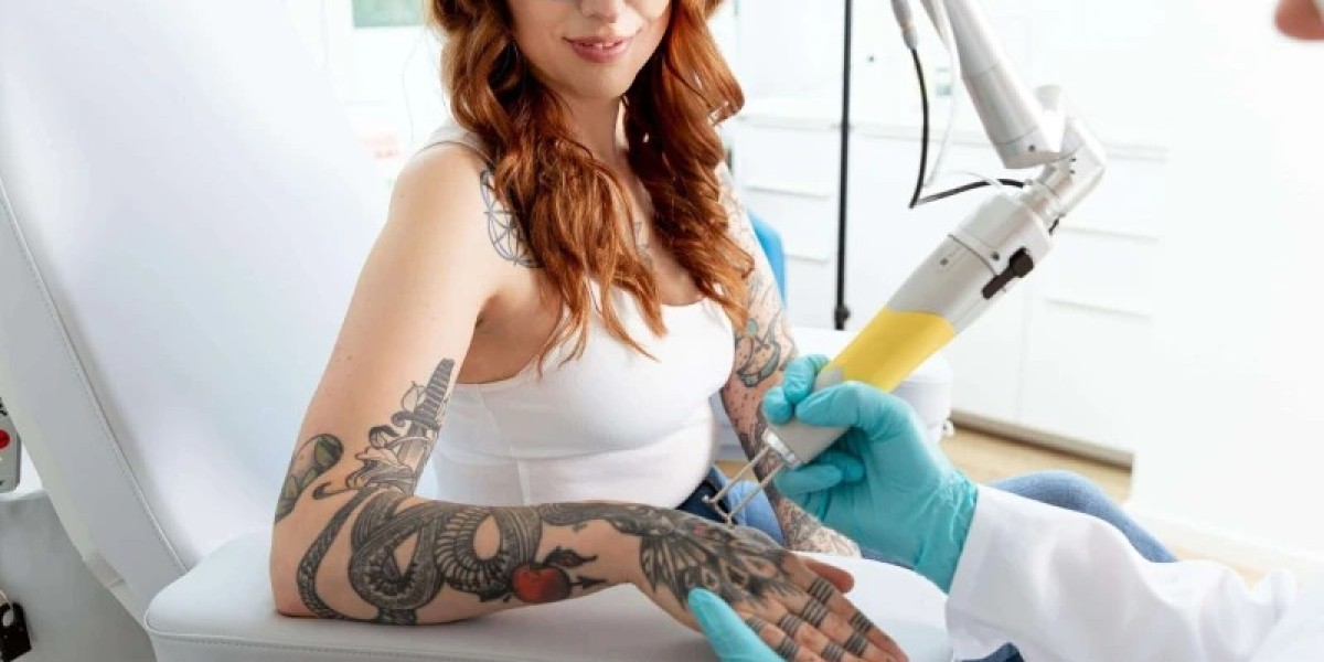 Can Old Tattoos Disappear Safely With Laser Tattoo Removal Now?