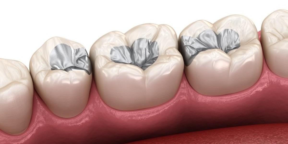 Preventing Damage to Your Dental Tooth Filling