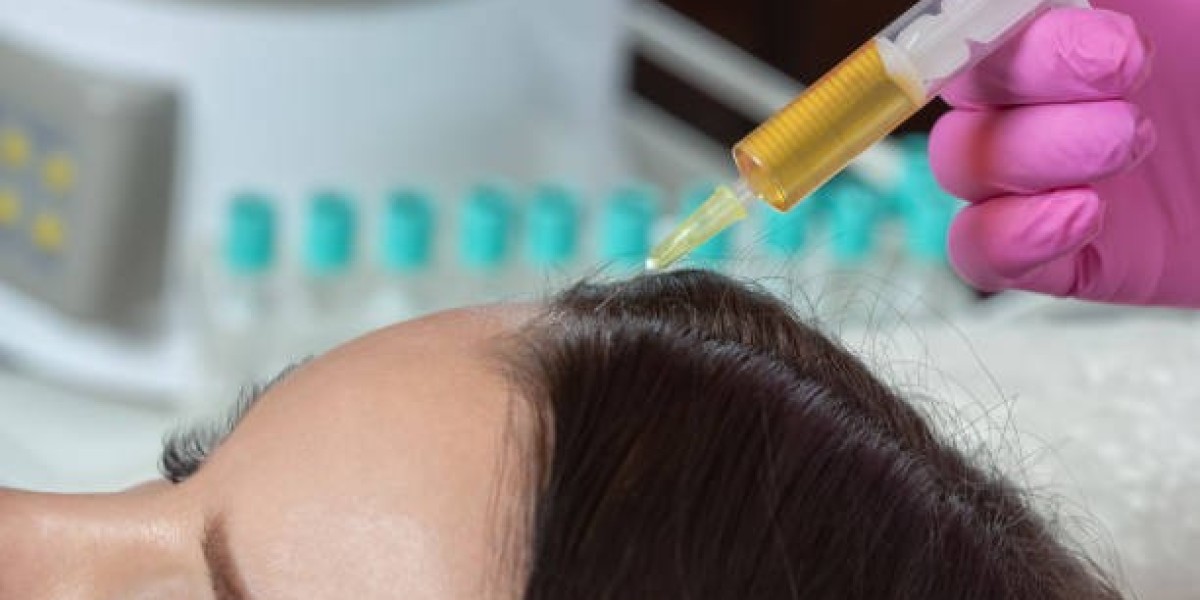 PRP Hair Treatment Post Orthodontics: Jaw Scalp Nerve Impact