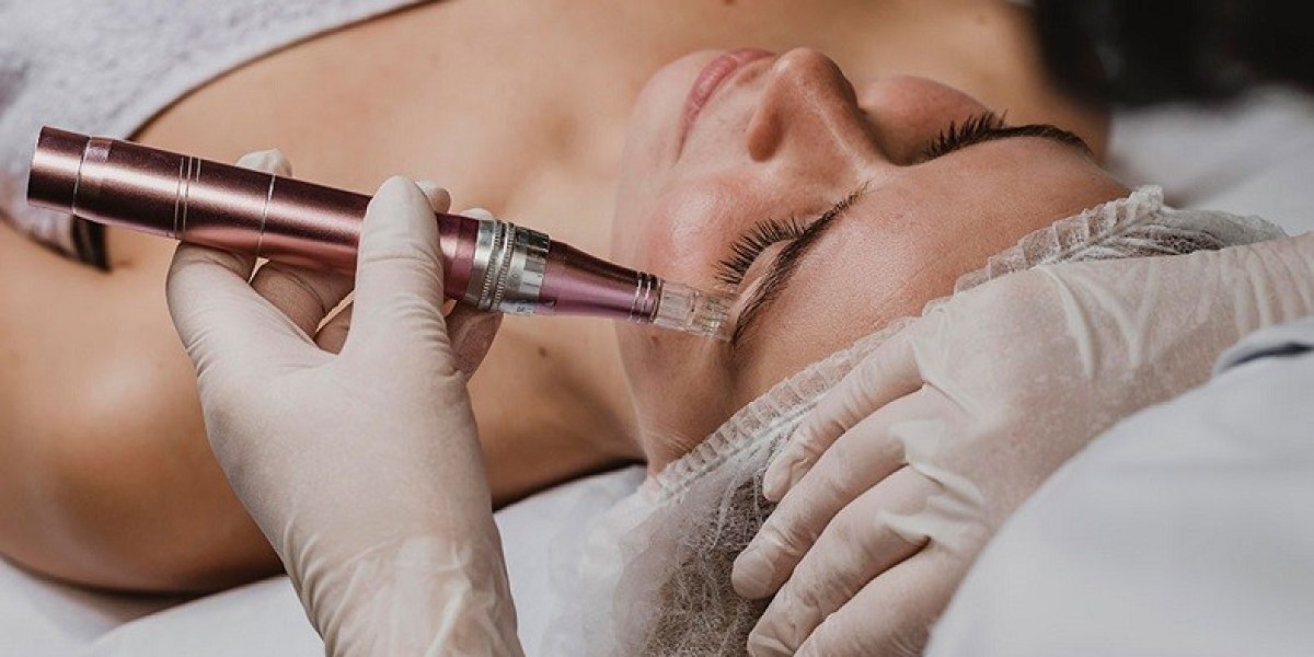 Dermapen Treatment Dubai: Skin Boost Secrets