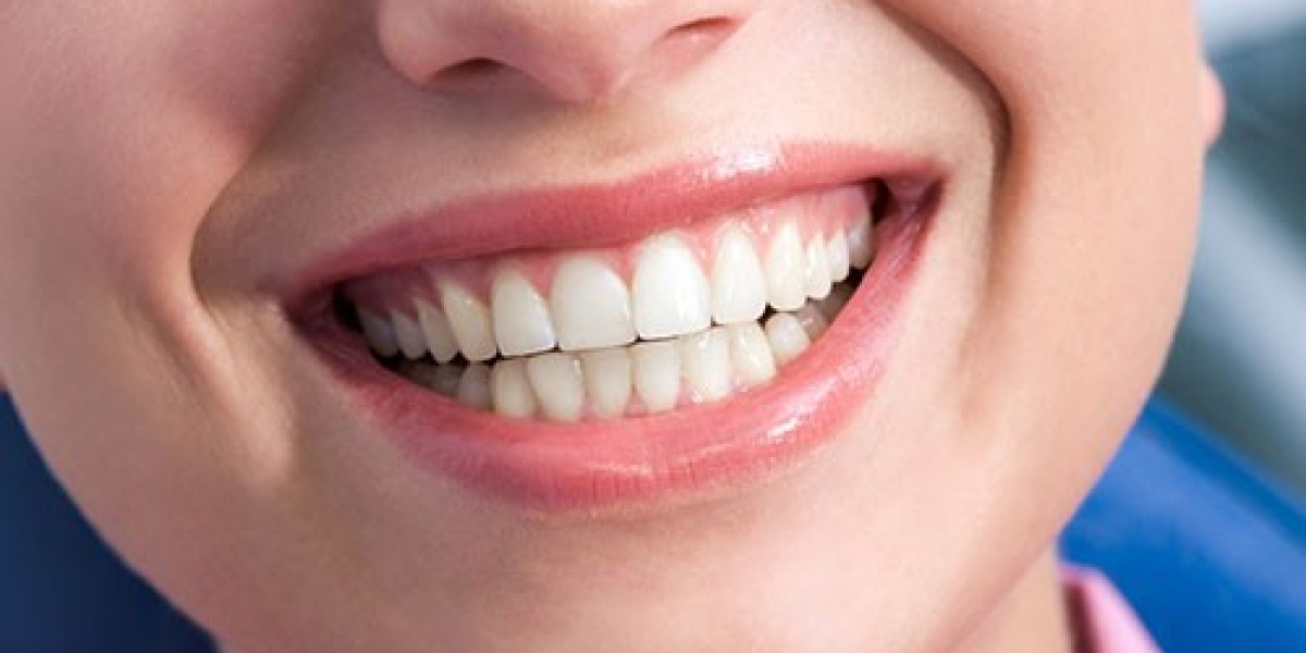 Can Laser Gum Treatment Fix Age-Related Discoloration?