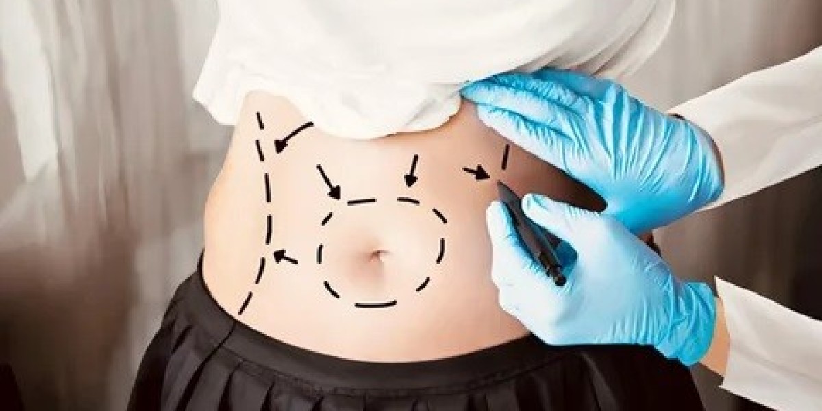 Can Bariatric Surgery in Islamabad Improve Heart Health?