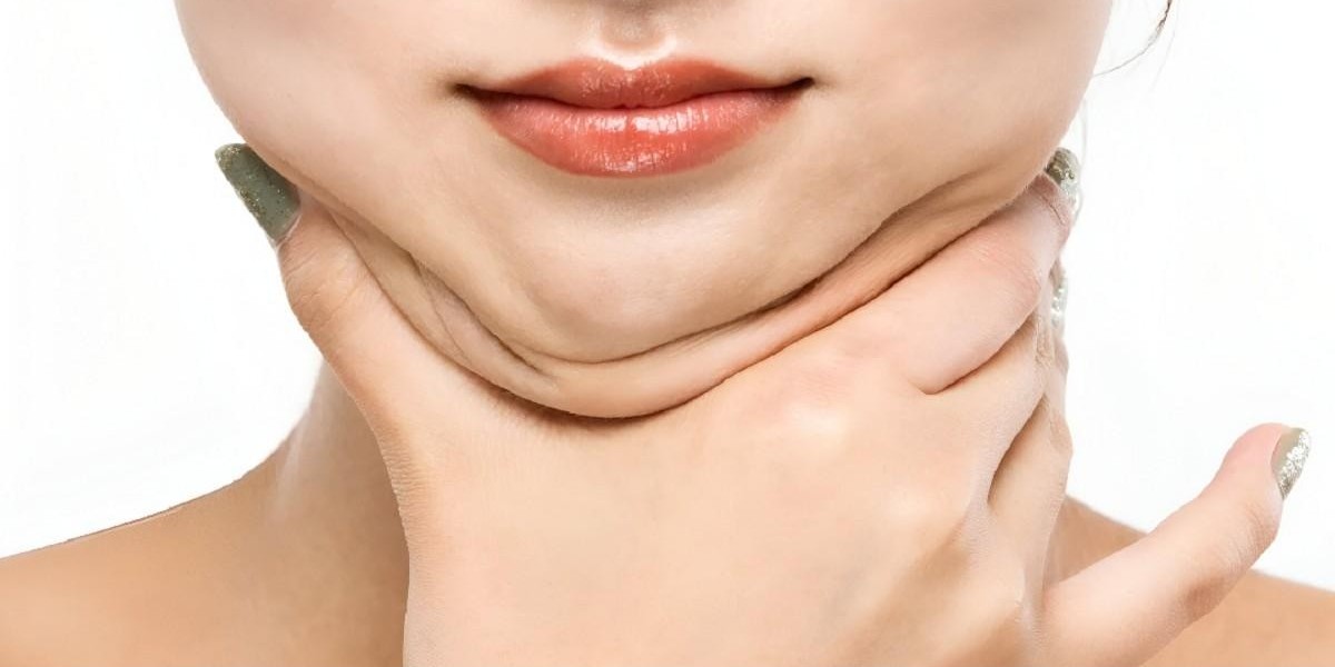 Double Chin Liposuction in Islamabad for Jaw Aesthetics