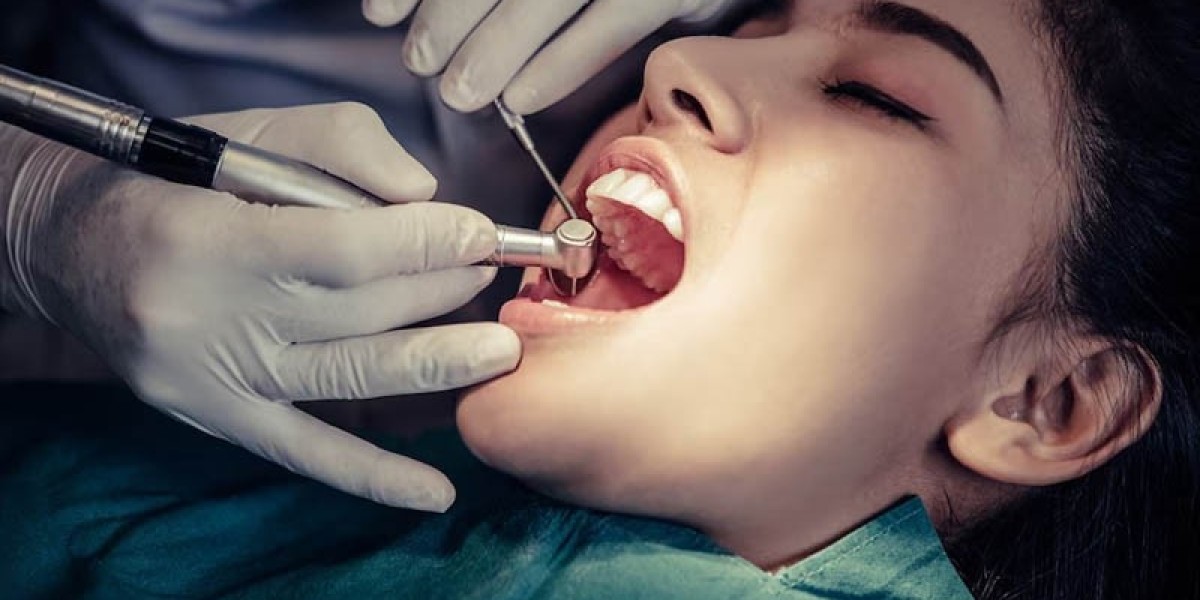 How long does a root canal last for?