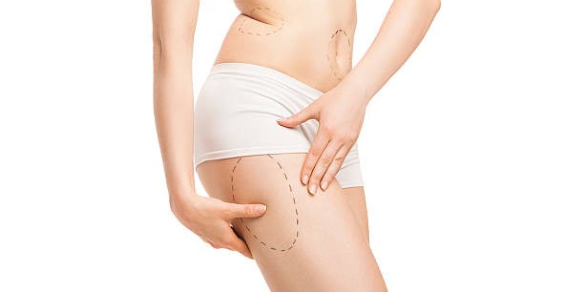Liposuction Procedure in Floating Clinics: Innovative Access
