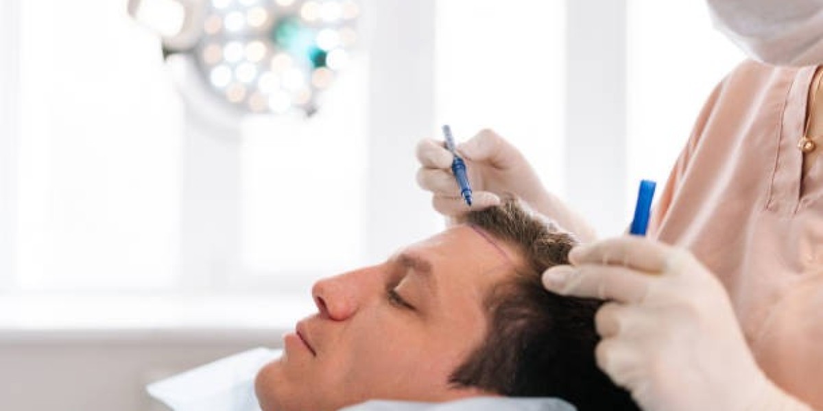 Dubai Hair Transplant Pricing Guide: What You Should Know