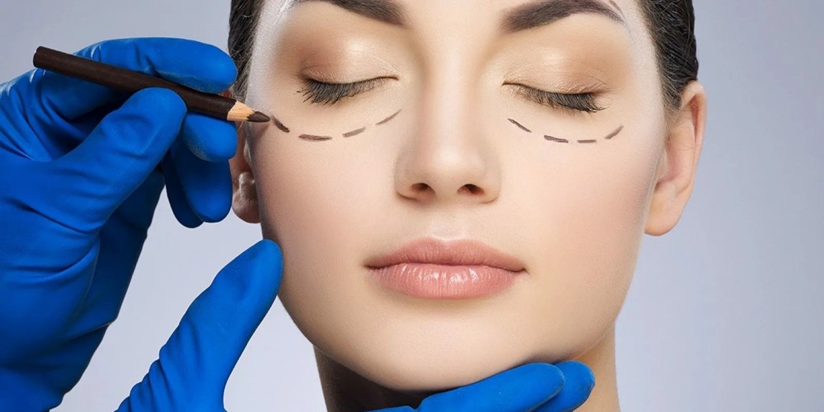 How Long Does Recovery Take After Eyelid Surgery in Islamabad?