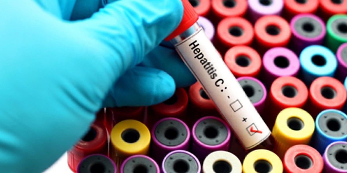 Hepatitis C Test in Dubai: Lab & Diagnostic Services