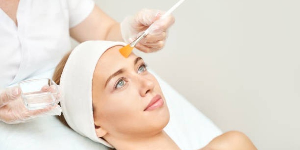 Why More People Are Choosing Chemical Peels in Dubai for Skin Renewal