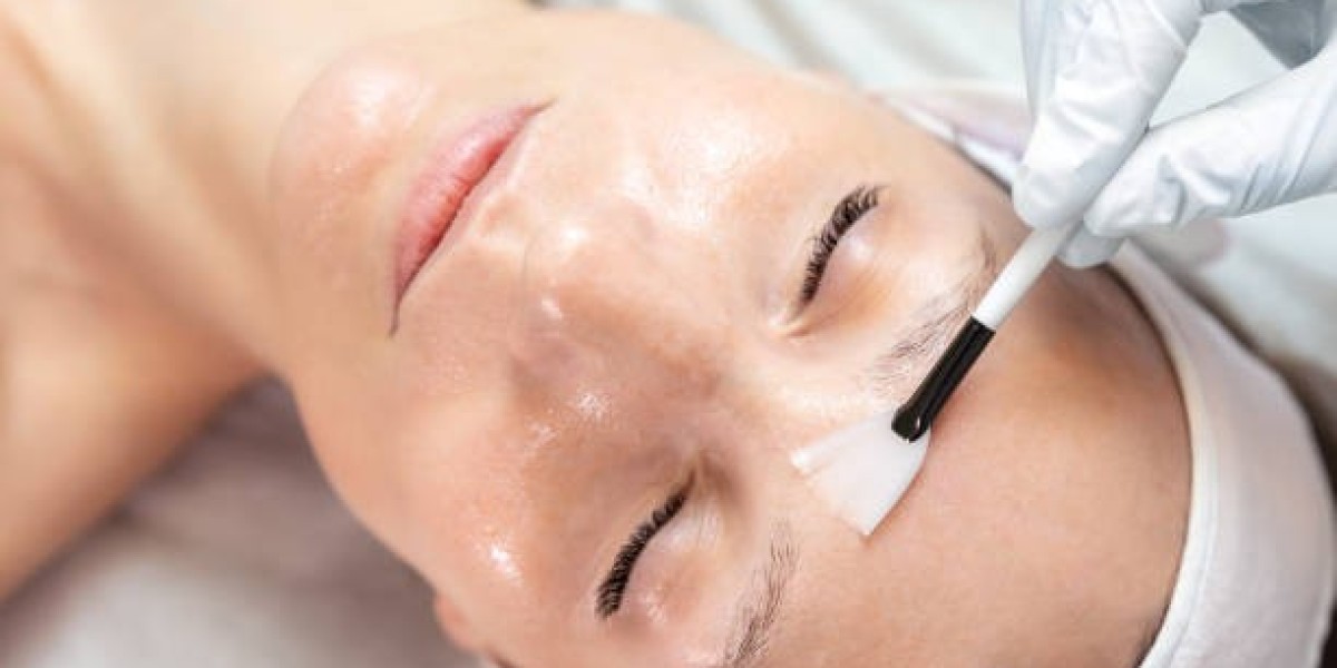 From Dull to Radiant: Transform Your Complexion with Chemical Peels in Dubai