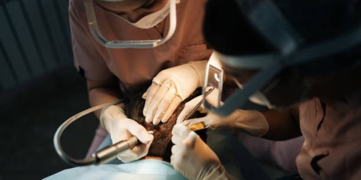 Tips to Manage Hair Transplant Cost Without Compromising Quality