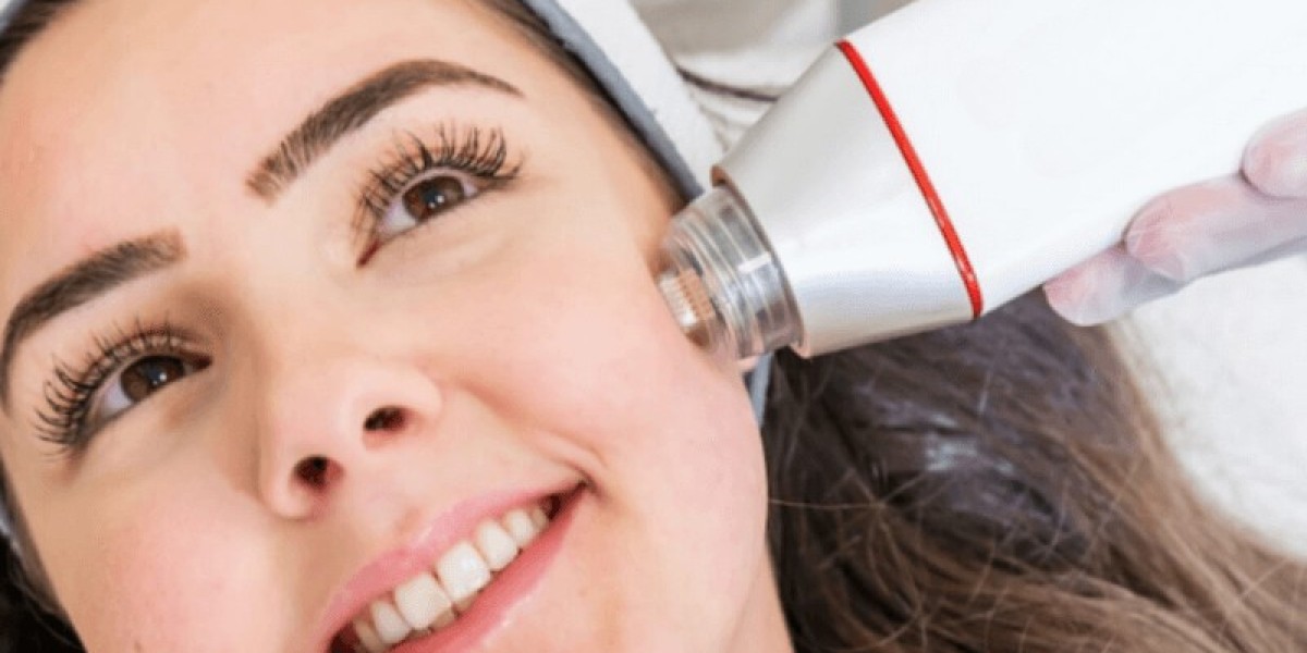 Fractional RF Microneedling in Dubai: Expert Advice for Optimal Skin Health