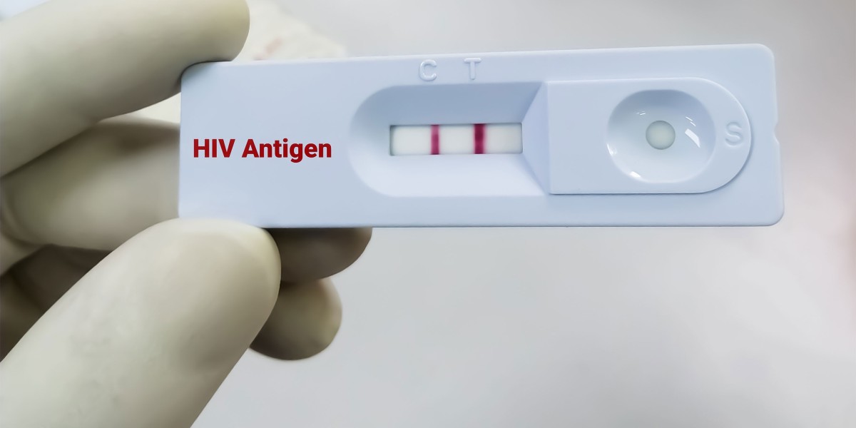 How Long Does an HIV Test Take?