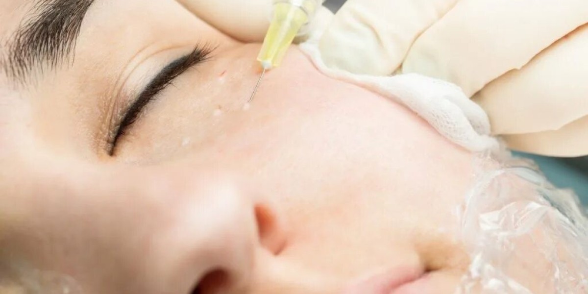 How Dermatech Polyclinic Addresses Common Skin Concerns?