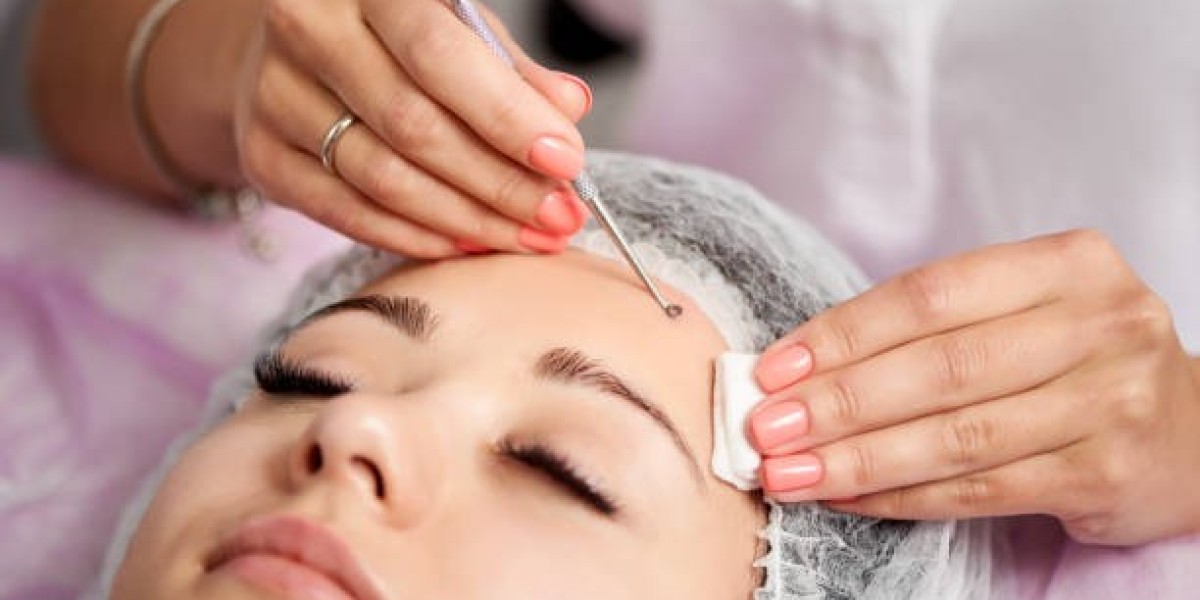 Wart Removal Aftercare to Prevent Scars in Riyadh