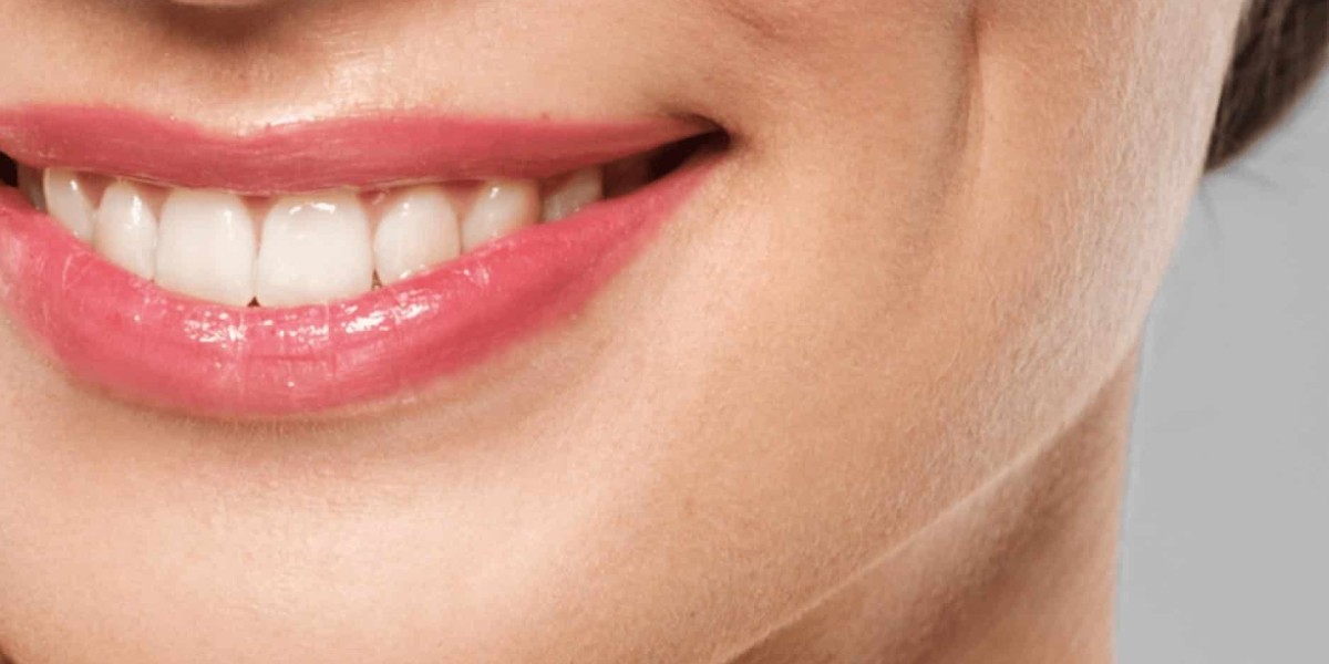 What Should You Expect During a Dimple Creation in Islamabad Procedure?