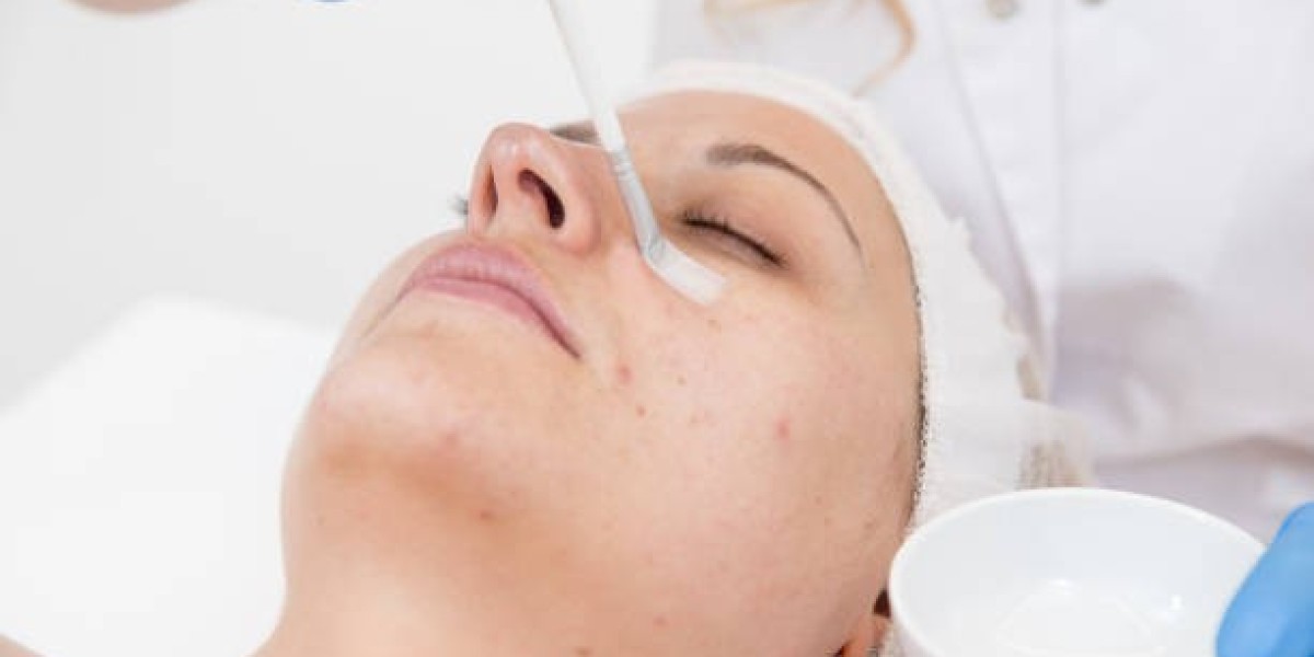 The Growing Demand for Chemical Peels in Dubai for Skin Health
