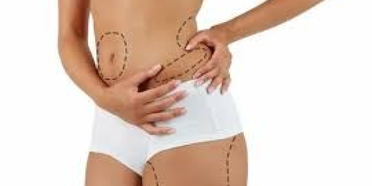Follow-Up Appointments: Ensuring a Smooth Recovery After Liposuction in Islamabad