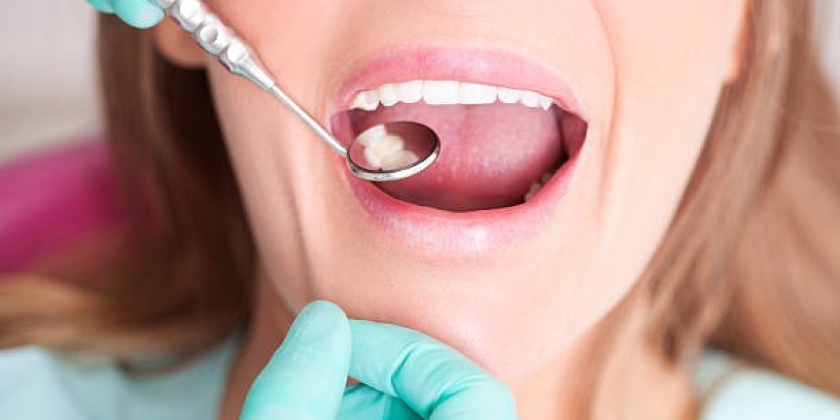 Restore Your Smile with Expert Dental Fillings