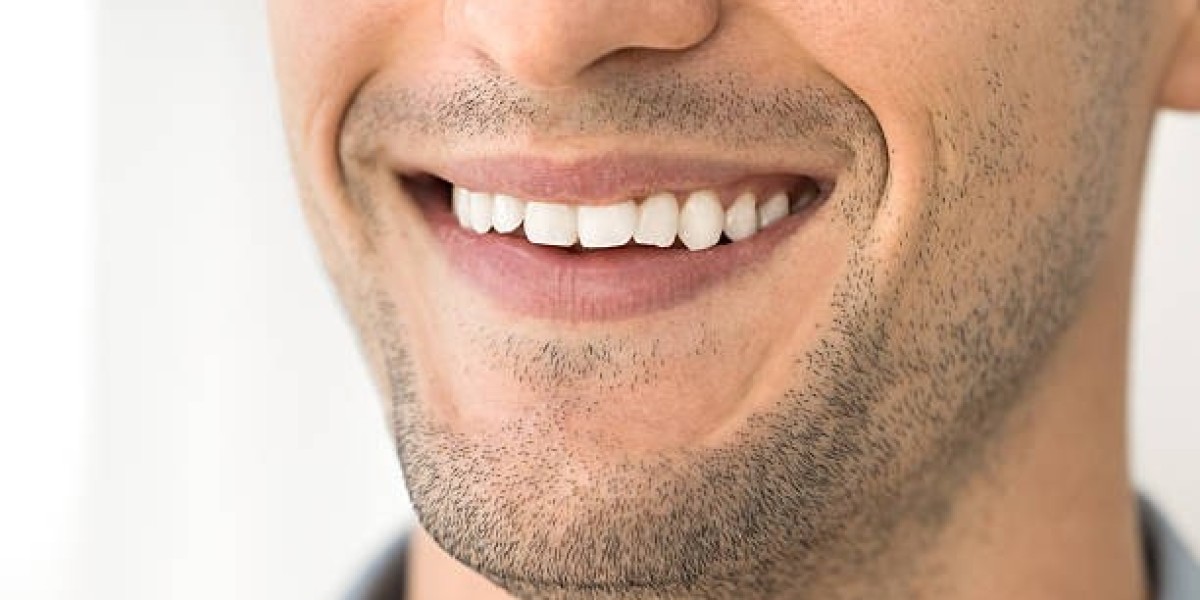 Transform Your Teeth and Boost Confidence