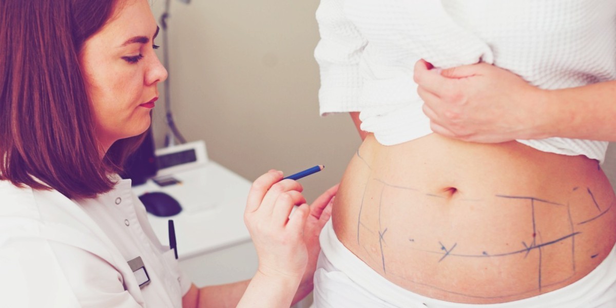 علاج ليبوماتيك في الرياض بإشراف طبي متخصص