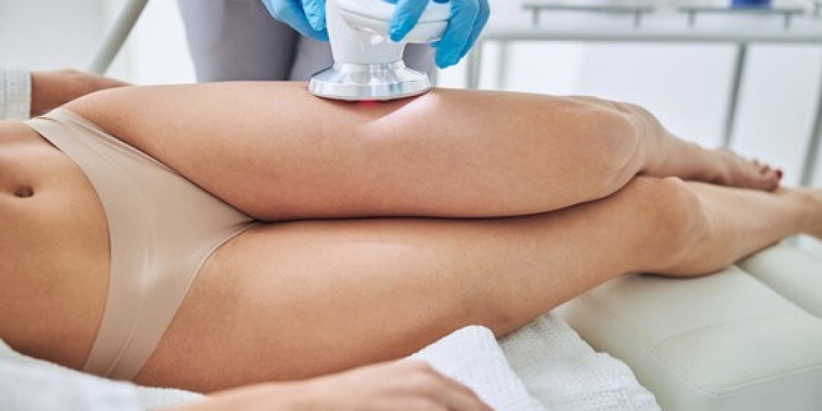 نحت الجسم في الرياض لشد الترهلات