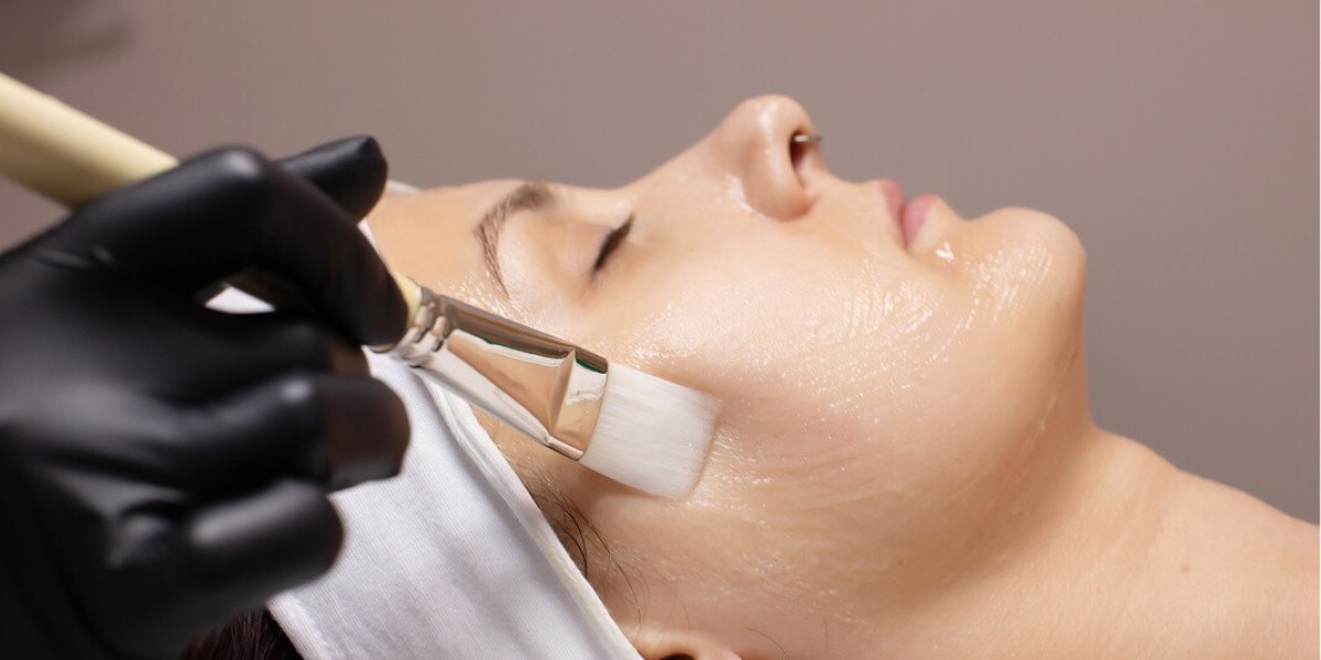Are Chemical Peels Safe for Indian Skin? What You Should Know