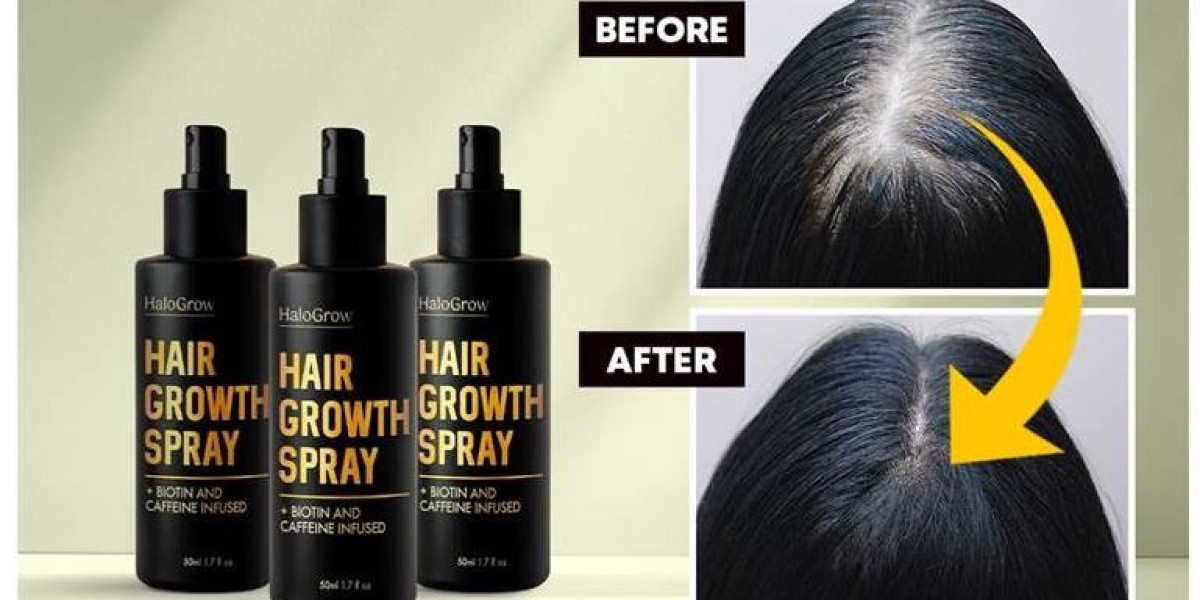 Snidin Hair Growth Spray Reviews And Complaints-Benefits of Using Hair Growth Spray for Stronger, Thicker Hair!